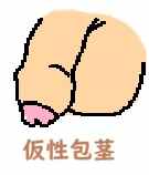 包茎じゃない人