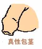 包茎じゃない人
